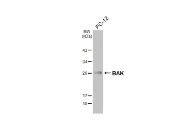 Anti-BAK antibody [N1N2], N-term used in Western Blot (WB). GTX100063