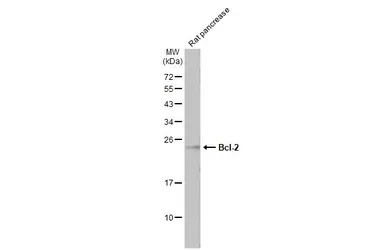Anti-Bcl-2 antibody [N1N2], N-term used in Western Blot (WB). GTX100064