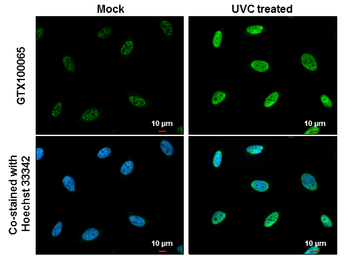 Anti-Chk1 (phospho Ser345) antibody [C1C2], Internal used in Immunocytochemistry/ Immunofluorescence (ICC/IF). GTX100065