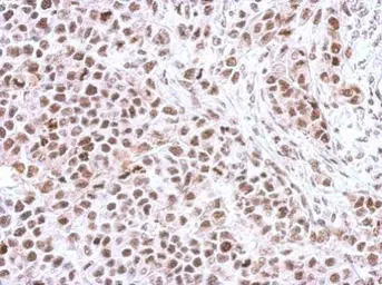 Anti-Chk1 (phospho Ser345) antibody [C1C2], Internal used in IHC (Paraffin sections) (IHC-P). GTX100065