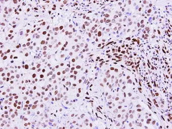 Anti-RecQ1 antibody [N1N2], N-term used in IHC (Paraffin sections) (IHC-P). GTX100084