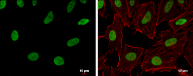 Anti-RecQ1 antibody [N1N2], N-term used in Immunocytochemistry/ Immunofluorescence (ICC/IF). GTX100084
