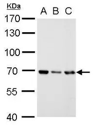 Anti-RecQ1 antibody [N1N2], N-term used in Western Blot (WB). GTX100084