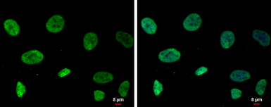 Anti-RecQ1 antibody [C1C3] used in Immunocytochemistry/ Immunofluorescence (ICC/IF). GTX100085