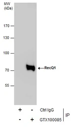 Anti-RecQ1 antibody [C1C3] used in Immunoprecipitation (IP). GTX100085