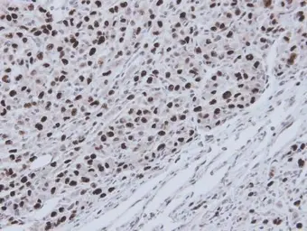 Anti-RecQ1 antibody [C1C3] used in IHC (Paraffin sections) (IHC-P). GTX100085