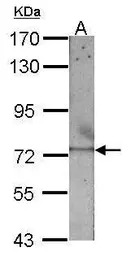 Anti-RecQ1 antibody [C1C3] used in Western Blot (WB). GTX100085