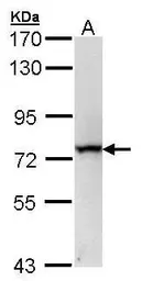 Anti-RecQ1 antibody [C1C3] used in Western Blot (WB). GTX100085