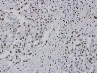 Anti-RPA14 antibody used in IHC (Paraffin sections) (IHC-P). GTX100088