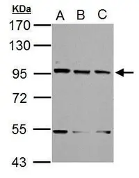 Anti-XAB2 antibody [N1N2], N-term used in Western Blot (WB). GTX100090
