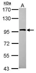 Anti-XAB2 antibody [N1N2], N-term used in Western Blot (WB). GTX100090