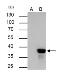 Anti-XLF antibody [N3C3] used in Immunoprecipitation (IP). GTX100092