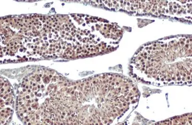 Anti-DNA ligase IV antibody [N2C2], Internal used in IHC (Paraffin sections) (IHC-P). GTX100100