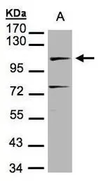Anti-DNA ligase IV antibody [N2C2], Internal used in Western Blot (WB). GTX100100