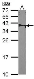 Anti-XRCC2 antibody [N1N3] used in Western Blot (WB). GTX100113