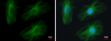 Anti-beta Tubulin 2 antibody used in Immunocytochemistry/ Immunofluorescence (ICC/IF). GTX100117