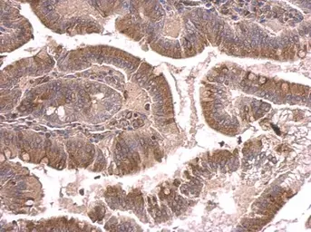 Anti-beta Tubulin 2 antibody used in IHC (Paraffin sections) (IHC-P). GTX100117