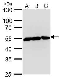Anti-beta Tubulin 2 antibody used in Western Blot (WB). GTX100117