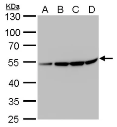 Anti-beta Tubulin 2 antibody used in Western Blot (WB). GTX100117