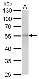 Anti-beta Tubulin 2 antibody used in Western Blot (WB). GTX100117