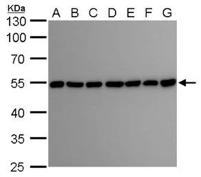 Anti-beta Tubulin 2 antibody used in Western Blot (WB). GTX100117