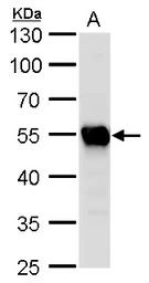 Anti-beta Tubulin 2 antibody used in Western Blot (WB). GTX100117