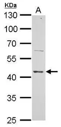 Anti-ERCC8 antibody used in Western Blot (WB). GTX100122