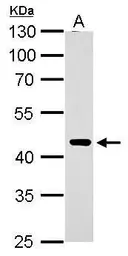 Anti-ERCC8 antibody used in Western Blot (WB). GTX100122