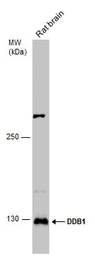 Anti-DDB1 antibody used in Western Blot (WB). GTX100130