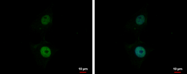 Anti-BCL7A antibody [C2C3], C-term used in Immunocytochemistry/ Immunofluorescence (ICC/IF). GTX100197