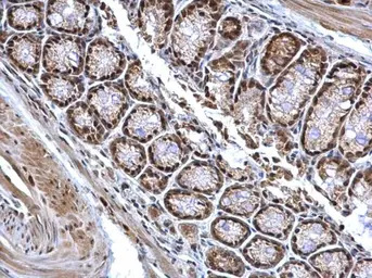 Anti-BCL7A antibody [C2C3], C-term used in IHC (Paraffin sections) (IHC-P). GTX100197