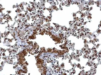 Anti-BCL7A antibody [C2C3], C-term used in IHC (Paraffin sections) (IHC-P). GTX100197
