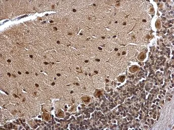 Anti-BCL7A antibody [C2C3], C-term used in IHC (Paraffin sections) (IHC-P). GTX100197