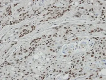 Anti-BCL7A antibody [C2C3], C-term used in IHC (Paraffin sections) (IHC-P). GTX100197