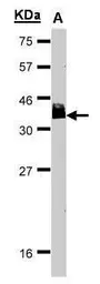 Anti-BCL7A antibody [C2C3], C-term used in Western Blot (WB). GTX100197