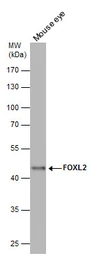 Anti-FOXL2 antibody [C3], C-term used in Western Blot (WB). GTX100200