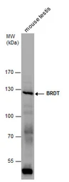 Anti-BRDT antibody [C3], C-term used in Western Blot (WB). GTX100201