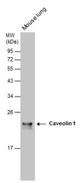 Anti-Caveolin 1 antibody [N1N3] used in Western Blot (WB). GTX100205