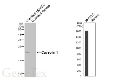Anti-Caveolin 1 antibody [N1N3] used in Western Blot (WB). GTX100205