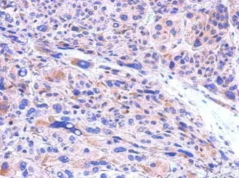 Anti-CBR1 antibody [C2C3], C-term used in IHC (Paraffin sections) (IHC-P). GTX100207