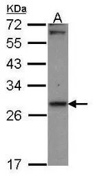 Anti-CBR1 antibody [C2C3], C-term used in Western Blot (WB). GTX100207