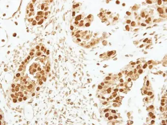 Anti-CENPF antibody [C3], C-term used in IHC (Paraffin sections) (IHC-P). GTX100212
