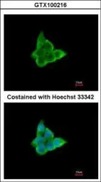 Anti-CIS antibody [C2C3], C-term used in Immunocytochemistry/ Immunofluorescence (ICC/IF). GTX100216