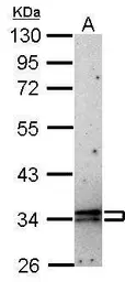 Anti-CIS antibody [C2C3], C-term used in Western Blot (WB). GTX100216