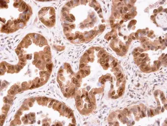 Anti-CIS antibody [C2C3], C-term used in IHC (Paraffin sections) (IHC-P). GTX100216