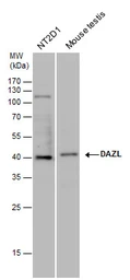 Anti-DAZL antibody used in Western Blot (WB). GTX100230