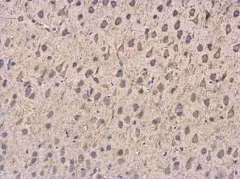 Anti-DCTN1 antibody [C3], C-term used in IHC (Paraffin sections) (IHC-P). GTX100231