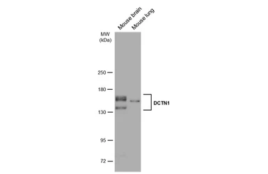 Anti-DCTN1 antibody [C3], C-term used in Western Blot (WB). GTX100231