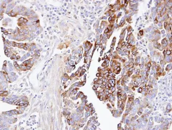 Anti-DCTN1 antibody [C3], C-term used in IHC (Paraffin sections) (IHC-P). GTX100231