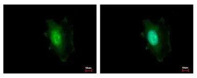 Anti-DDB1 antibody [C3], C-term used in Immunocytochemistry/ Immunofluorescence (ICC/IF). GTX100232